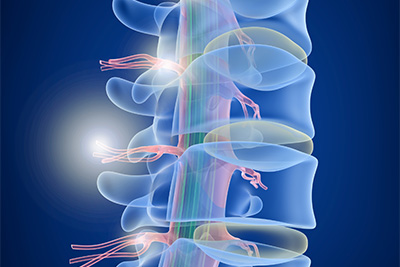 3D X-Ray Imaging